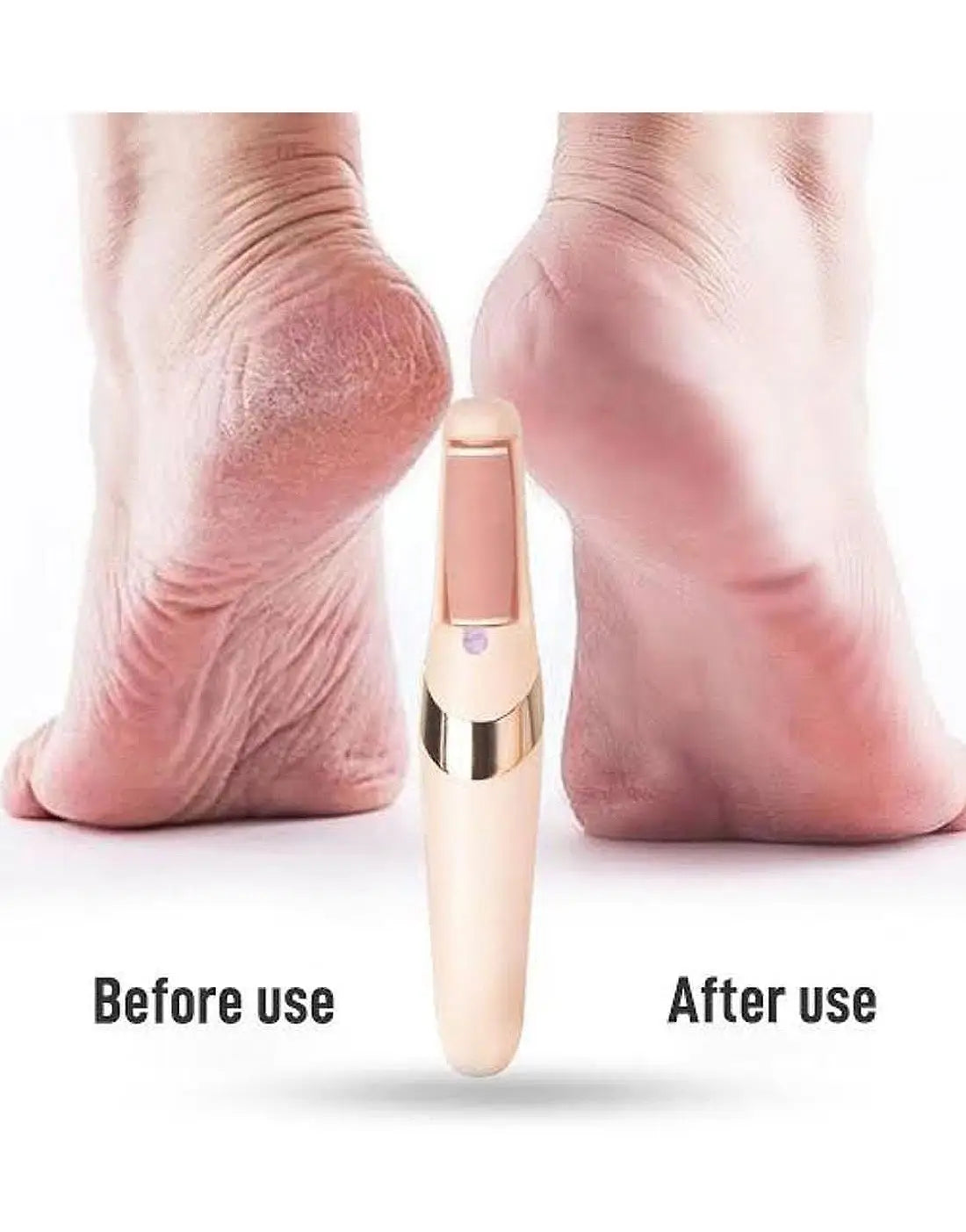 WEIMEI Rechargeable Electric Foot File Callus Remover – Wet & Dry Pedicure Foot Scrubber for Smooth, Soft Feet